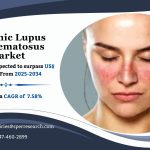 Systemic Lupus Erythematosus Market Size, Growth, Trend Analysis and Business Opportunities 2034: SPER Market Research