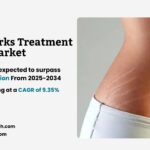 Stretch Marks Treatment Market Size and Share
